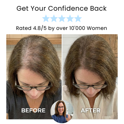 Allvero Hair Revival Roller